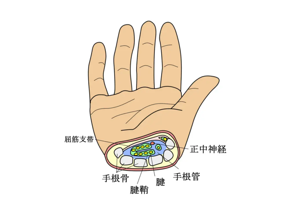 朝 手 が 痺れる